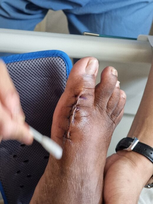 post-op instruction after Having Surgery in South Korea